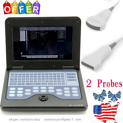 #ad US sale Notebook B ultrasound diagnostic System3.5Mhz Convex with 7.5Mhz linear $1649.00