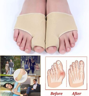 #ad 1 Pair Big Toe Bunion Corrector Splint Straightener Hallux Valgus Pain Relief US $4.65