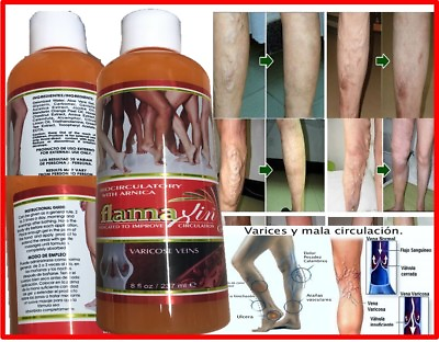 #ad Herbal Ointment Varicose Veins Vasculitis Support Foot Care Cream leg gel cream $12.50