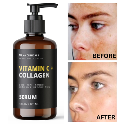 #ad Vitamin C serum Collagen Skin Brightening Anti aging Wrinkles SERUM 4oz $18.99