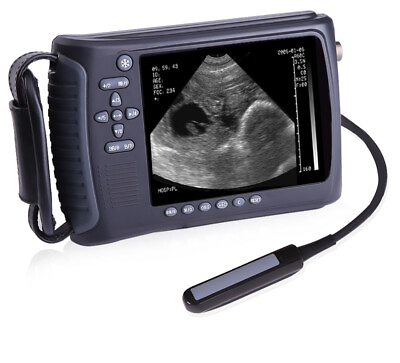 #ad Full Digital Palmtop Bladder Ultrasound Scanner Color Machine With Convex Probe $1748.31