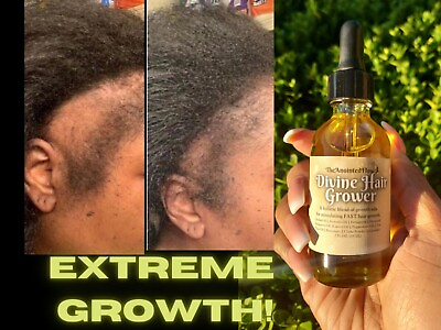 #ad FAST HAIR GROWTH Organic Growth Oil Balding Thin Edges Alopecia Chebe Miracle $14.00