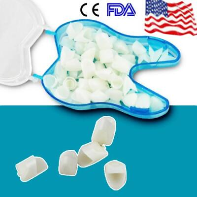 #ad 60pcs box Anterior Teeth Caps Front Tooth Temporary Crown Dental Treatment New $8.99